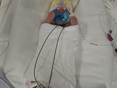 Babypuppe an der ein Eingriff gezeigt wird