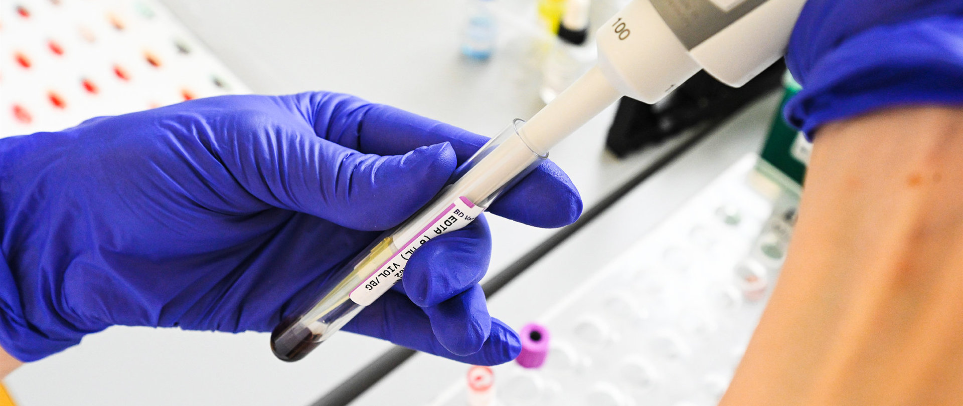 Hände in blauen Handschuhen halten ein Blutentnahmeröhrchen